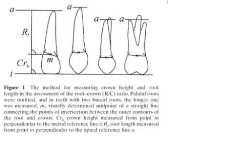 Crown root ratio measurement method