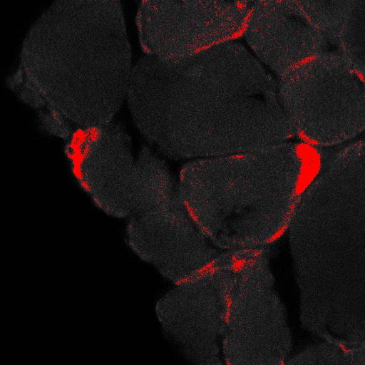 this is the masked nerve channel containing 2 endplates. I would like to analyse them individually